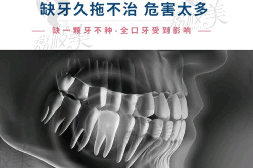 珠海諾貝爾口腔