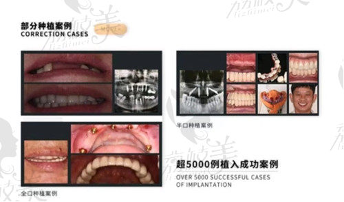 珠海諾貝爾口腔