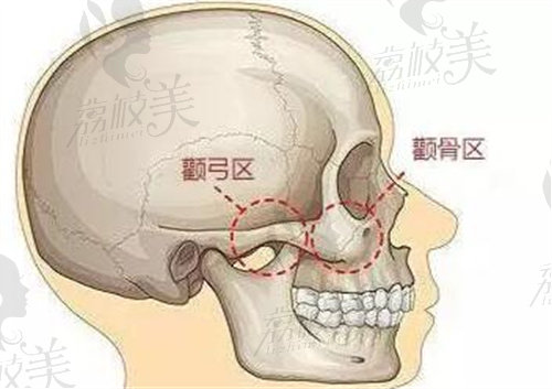 顴骨區(qū)展示