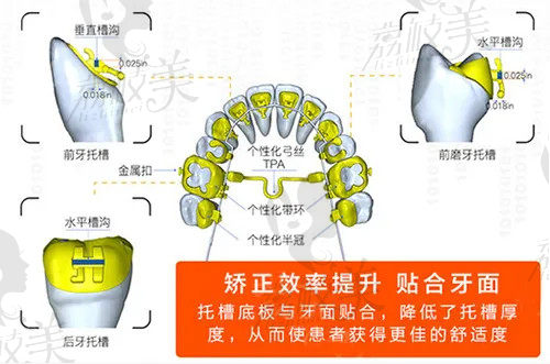 趙中華院長舌側(cè)矯正優(yōu)勢