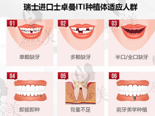 惠阳优梨口腔