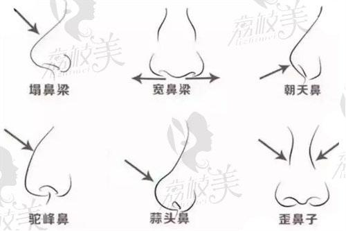 深圳美萊醫(yī)療美容做鼻子哪個(gè)醫(yī)生好？