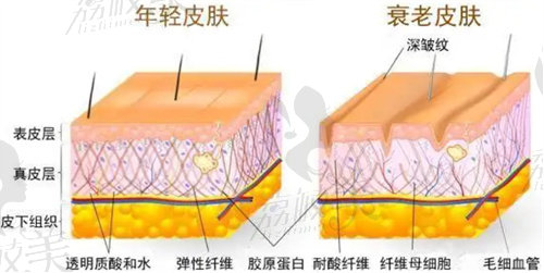 速提美手术怎么样？