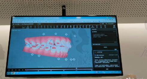 孫丹陽醫(yī)生數(shù)字化正畸