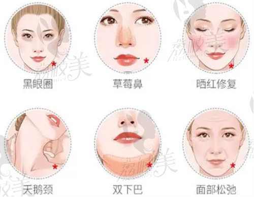 面部抗衰选择哪一种方式好？