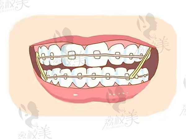 牙齿3