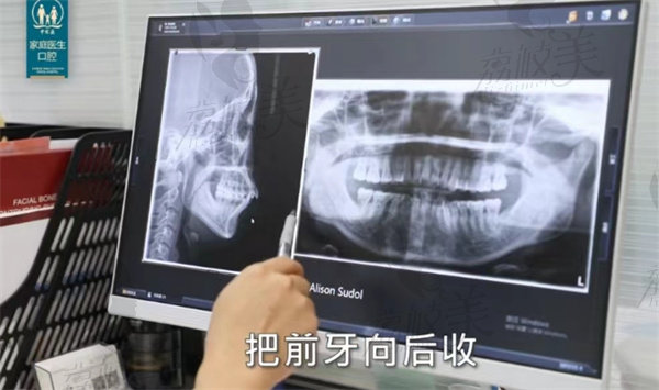 拍片