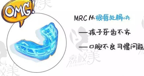 4岁儿童地包天矫正过程痛苦么