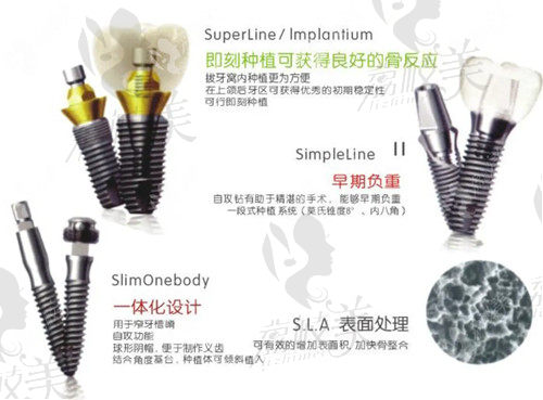 韩国奥齿泰种植体优势