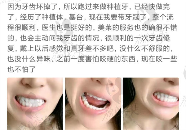 广州美莱口腔点评2