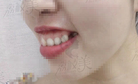 江门壹心唯美口腔整牙