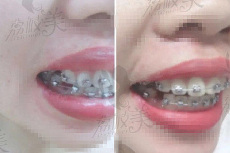 江门壹心唯美口腔整牙