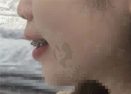 江门壹心唯美口腔整牙