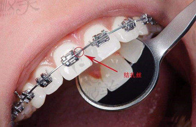 许沛霞医生在牙齿矫正方面的技术优势2