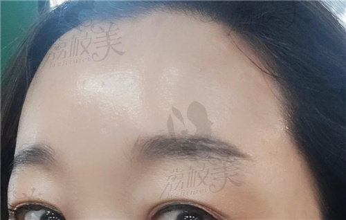 韩国大眼睛整形医院做双眼皮技术好