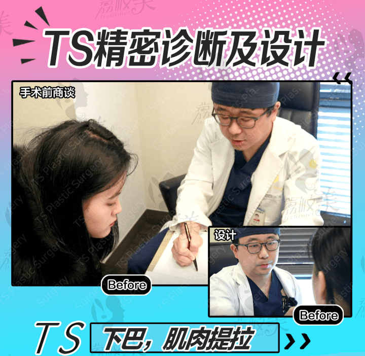 韩国TS下巴手术前面诊
