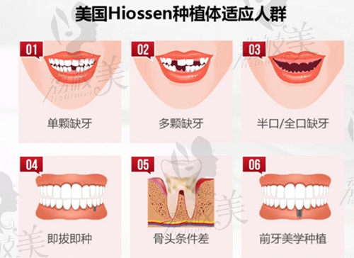 深圳雅贝康口腔