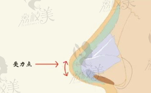 广州曙光蒋思军做鼻子好吗