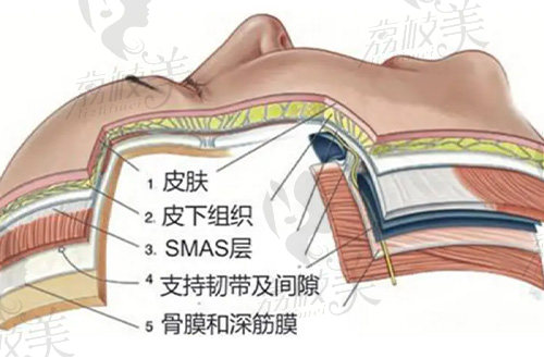 上海美莱美容拉皮技术好