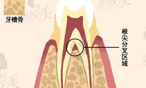 牙槽骨