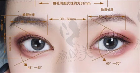 杭州双眼皮修复多少钱？