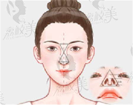 杭州艺星张龙做鼻子风格怎么样？