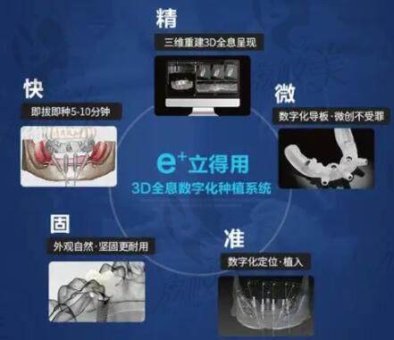 e+立得用数字化种植牙