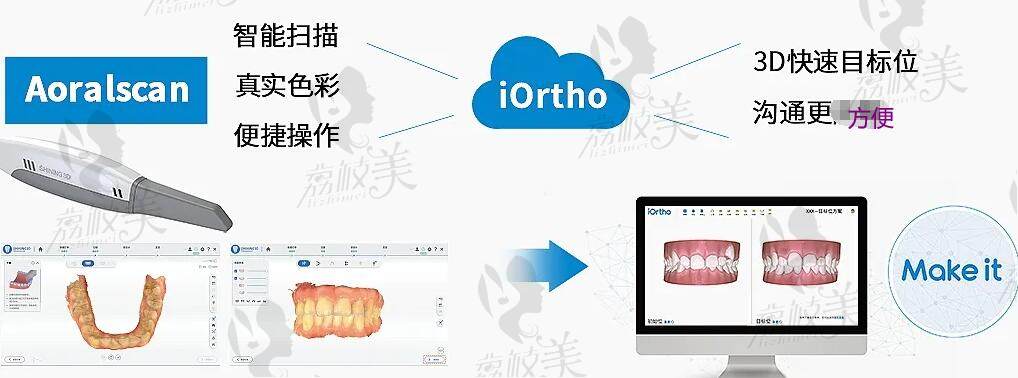 邯鄲正植口腔牙齒矯正怎么樣