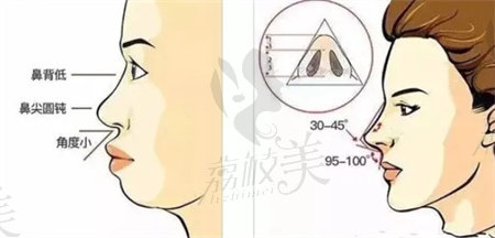 吴艾竞做鼻子技术怎么样？