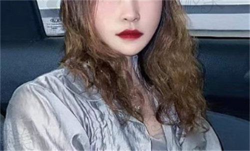 罗恩下颌角术后