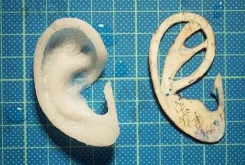 Su—por生物支架耳再造形态