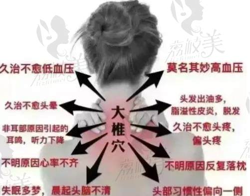 富貴包導(dǎo)致的問題