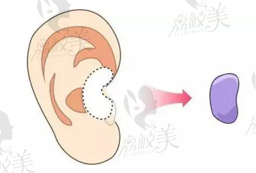 邱文苑做鼻子的特点是什么