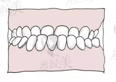 龙小芳医生在牙齿矫正方面的技术优势2