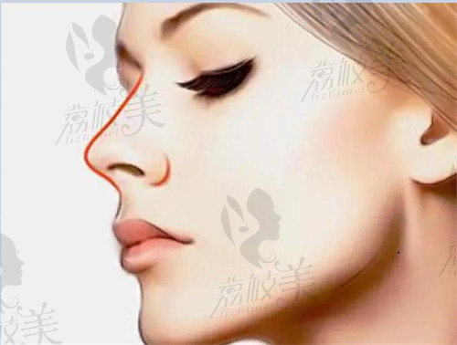 鼻部曲线图