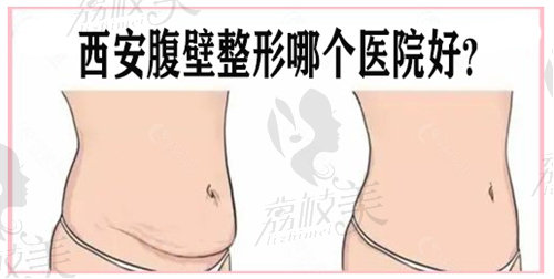 西安腹壁成形手術(shù)哪里做的好？