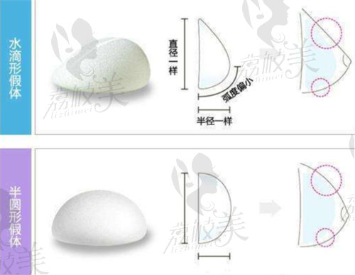 水滴以及半圓形假體材料