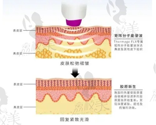 中山愛匯星熱瑪吉技術高