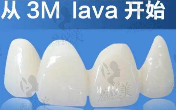 美国3M LAVA拉瓦全瓷牙