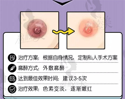 乳晕缩小的治疗方案