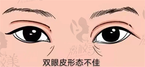 周长兵眼修复实例多吗？