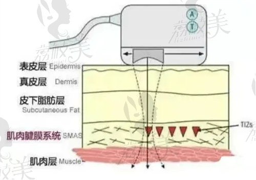 中山韩妃皮肤护理技术好