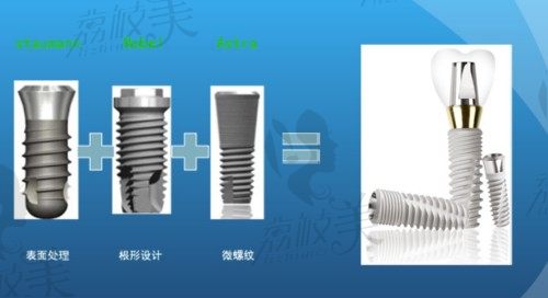 仕諾康植體材料