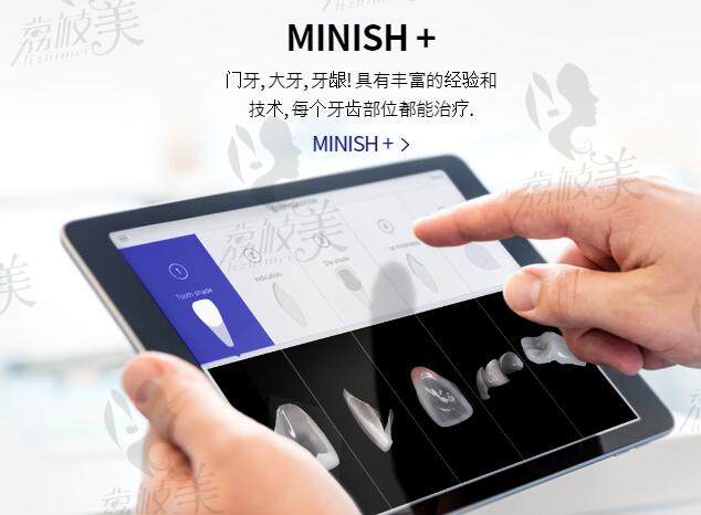 minish牙齿贴面优势