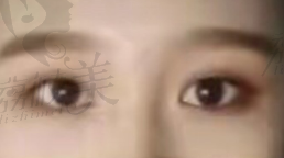 四川美莱雷蕾医生双眼皮评价.png