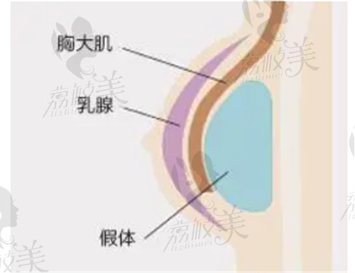 王斌隆胸技術(shù)口碑良好