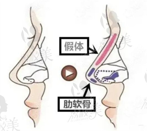 鄭州美萊姜南做鼻子怎么樣