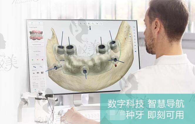 深圳麦芽口腔all-on-4种植牙技术