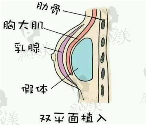 中山愛匯星石愷擅長雙平面隆胸技術(shù)