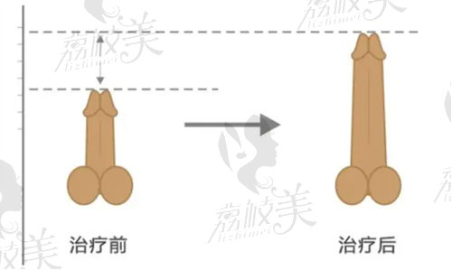 國(guó)內(nèi)男科私密手術(shù)醫(yī)院排名榜公布